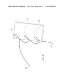 SUTURE PASSER AND METHOD diagram and image