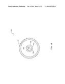 OCCLUSION DEVICE diagram and image