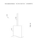 OCCLUSION DEVICE diagram and image