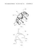 Left Atrial Appendage Occluder diagram and image