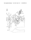 MEDICAL GUIDING DEVICE diagram and image