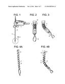 Percutaneous Disc Clearing Device diagram and image