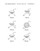 GLENOID REPAIR SYSTEM AND METHODS OF USE THEREOF diagram and image