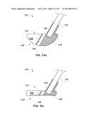 GLENOID REPAIR SYSTEM AND METHODS OF USE THEREOF diagram and image