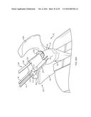 GLENOID REPAIR SYSTEM AND METHODS OF USE THEREOF diagram and image