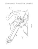 GLENOID REPAIR SYSTEM AND METHODS OF USE THEREOF diagram and image