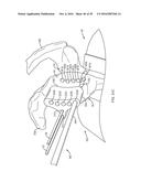 GLENOID REPAIR SYSTEM AND METHODS OF USE THEREOF diagram and image