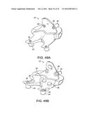 PATIENT-MATCHED INSTRUMENTS diagram and image