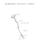 METHOD FOR REMOVING CALCULUS FROM AN ACCESS SHEATH diagram and image