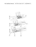 METHOD FOR REMOVING CALCULUS FROM AN ACCESS SHEATH diagram and image