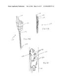 METHOD FOR REMOVING CALCULUS FROM AN ACCESS SHEATH diagram and image