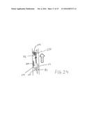 METHOD FOR REMOVING CALCULUS FROM AN ACCESS SHEATH diagram and image