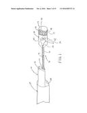 METHODS FOR REMOVING CALCULUS FROM AN ACCESS SHEATH diagram and image