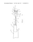 METHOD FOR REMOVING CALCULUS FROM AN ACCESS SHEATH diagram and image