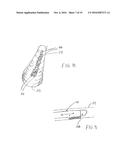 METHOD FOR REMOVING CALCULUS FROM AN ACCESS SHEATH diagram and image