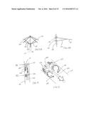 METHOD FOR REMOVING CALCULUS FROM AN ACCESS SHEATH diagram and image