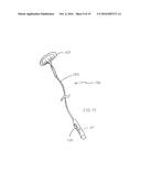 METHOD FOR REMOVING CALCULUS FROM AN ACCESS SHEATH diagram and image