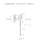 METHOD FOR REMOVING CALCULUS FROM AN ACCESS SHEATH diagram and image