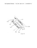 METHOD FOR REMOVING CALCULUS FROM AN ACCESS SHEATH diagram and image