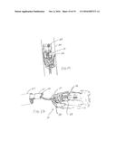 METHOD FOR REMOVING CALCULUS FROM AN ACCESS SHEATH diagram and image