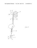 METHOD FOR RETRIEVING OBJECTS FROM A LIVING BODY diagram and image