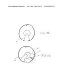 METHOD FOR RETRIEVING OBJECTS FROM A LIVING BODY diagram and image