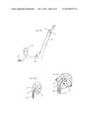 METHOD FOR RETRIEVING OBJECTS FROM A LIVING BODY AND EXPANDING A NARROWED     REGION IN THE LIVING BODY diagram and image