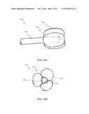 METHODS AND APPARATUS FOR TREATING EMBOLISM diagram and image