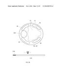 GUIDED THROMBUS  DISPERSAL CATHETER diagram and image