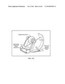 PIXEL ARRAY MEDICAL SYSTEMS, DEVICES AND METHODS diagram and image