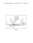 PIXEL ARRAY MEDICAL SYSTEMS, DEVICES AND METHODS diagram and image