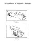 PIXEL ARRAY MEDICAL SYSTEMS, DEVICES AND METHODS diagram and image