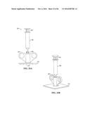 PIXEL ARRAY MEDICAL SYSTEMS, DEVICES AND METHODS diagram and image