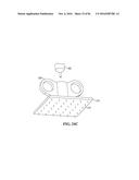 PIXEL ARRAY MEDICAL SYSTEMS, DEVICES AND METHODS diagram and image