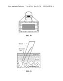 PIXEL ARRAY MEDICAL SYSTEMS, DEVICES AND METHODS diagram and image