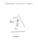 PIXEL ARRAY MEDICAL SYSTEMS, DEVICES AND METHODS diagram and image