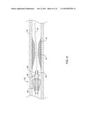 ATHERECTOMY MEDICAL DEVICE diagram and image