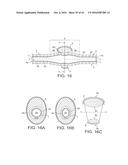 Rotational Atherectomy Device with Distal Protection Capability and Method     of Use diagram and image