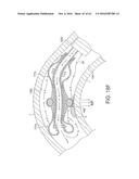 Rotational Atherectomy Device with Distal Protection Capability and Method     of Use diagram and image