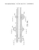 Rotational Atherectomy Device with Distal Protection Capability and Method     of Use diagram and image