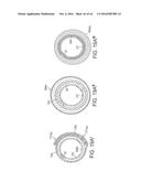 Rotational Atherectomy Device with Distal Protection Capability and Method     of Use diagram and image