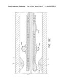 Rotational Atherectomy Device with Distal Protection Capability and Method     of Use diagram and image