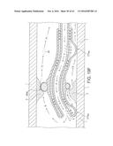 Rotational Atherectomy Device with Distal Protection Capability and Method     of Use diagram and image