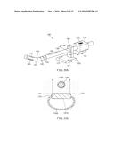 URETHRAL-INSERTION DEVICE diagram and image