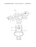 URETHRAL-INSERTION DEVICE diagram and image