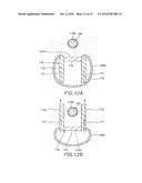 URETHRAL-INSERTION DEVICE diagram and image