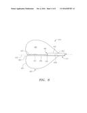 Apparatus And Methods For Placing Leads Using Direct Visualization diagram and image