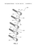 Disc and Motion Preserving Implant System diagram and image