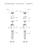 Disc and Motion Preserving Implant System diagram and image