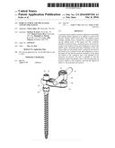 PEDICLE SCREW AND MULTI-AXIAL CONNECTOR SYSTEM diagram and image